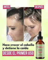 CapilRose™ – Aceite Capilar Natural