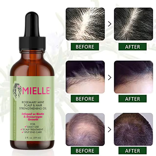 CapilRose™ – Aceite Capilar Natural